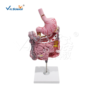 Modelo <span class=keywords><strong>de</strong></span> Enfermedad del Sistema Digestivo <span class=keywords><strong>de</strong></span> PVC, 2 Partes Desmontables, Estómago para Enseñanza <span class=keywords><strong>de</strong></span> Patología, CE ISO ROHS CNAS - Product Image 6