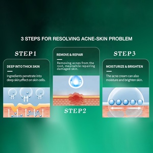 Beauty Host Ekstrak Tanaman Krim Pembersih Serum Asam Salisilat Anti-jerawat Mewah Ekstrak Tanaman Krim Wajah Anti-jerawat - Product Image 3