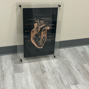 RAY YI personalizado estilo moderno acrílico hoja póster marco pared A3/1M X 1m - Product Image 1