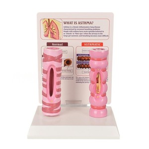 Modèle de comparaison de la trachée humaine saine et de la trachée asthmique |   <span class=keywords><strong>Aide</strong></span> pédagogique anatomique médicale pour l'éducation du système <span class=keywords><strong>respiratoire</strong></span> - Product Image 3