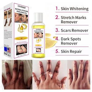 Private Label Skin Anti macchie scure esfoliante sbiancante rimozione delle nocche scure oli Peeling olio Peeling giallo Extra forte - Product Image 2