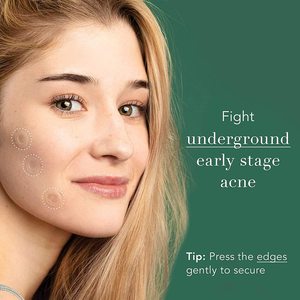 ENWEI Cerotto Microneedle per Acne con Acido Salicilico, Penetrazione Profonda, Anti-Infiammatorio, Detox, Trattamento Dissolvente per Macchie sul Viso Cistiche - Product Image 3