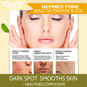 Crème <span class=keywords><strong>de</strong></span> <span class=keywords><strong>nuit</strong></span> pour le visage <span class=keywords><strong>à</strong></span> la vitamine C et <span class=keywords><strong>à</strong></span> l'arbutine <span class=keywords><strong>de</strong></span> marque privée Mestin, acide hyaluronique, glycérine, squalane, éclaircissante, hydratante, soin quotidien - Product Image 5