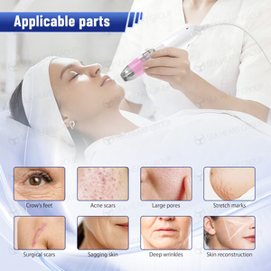 Macchina frazionaria/microneedling di microneedle rf della macchina di radiofrequenza approvata CE - Product Image 6