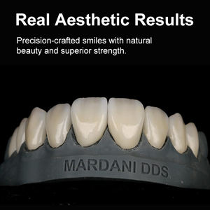 โรงงาน Ownsmile ขายส่งราคาโรงงาน วัสดุเซรามิกแก้วสำหรับงานทันตกรรม B40 LT HT สำหรับระบบกัดเซาะ วัสดุเซรามิกแก้วลิเธียมไดซิลิเกตสำหรับงานทันตกรรม - Product Image 5