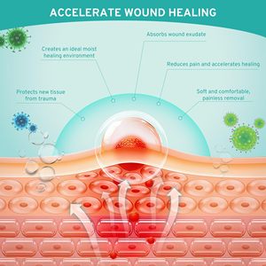 แผ่นปิดแผลไฮโดรคอลลอยด์ขนาดใหญ่พิเศษแบบยืดหยุ่นติดเองได้ ตัดขนาดได้ตามต้องการ - Product Image 4