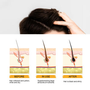 Shampooing noir <span class=keywords><strong>pour</strong></span> hommes, formule organique revitalisante <span class=keywords><strong>pour</strong></span> cheveux, couvrant les cheveux gris, emballage personnalisé, qualité salon - Product Image 6