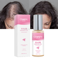 Label privé 100% naturel à base de plantes nourrissant élixir pour le cuir chevelu huile de ricin romarin soin des cheveux traitement de la perte de cheveux sérum d'huile de croissance des cheveux