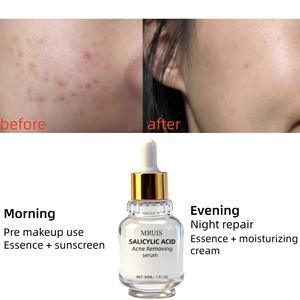 Sérum anti-acné sans huile, gel à l'<span class=keywords><strong>acide</strong></span> <span class=keywords><strong>salicylique</strong></span> + hamamélis, pour l'apparence des pores, apaisant pour la peau, non comédogène, sans parfum - Product Image 5