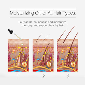 Etiqueta privada Cuidado del cabello Anti pérdida Aceite para el crecimiento del cabello Romero Cebolla roja para la pérdida del cabello Nutritivo Fortalecimiento Reparación Aceite para el cuero cabelludo - Product Image 4