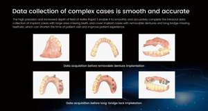 Aidite Dynamic odontotecnico uso dentale <span class=keywords><strong>Xray</strong></span> Scanner intraorale 3d - Product Image 5