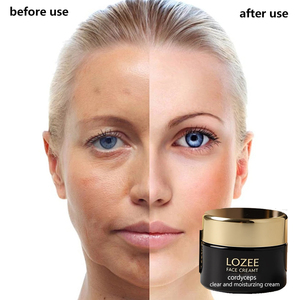 Crème éclaircissante anti-taches LOZEE, atténue le chloasma, les taches solaires, les taches de vieillesse, éclaircit le teint, hydrate, répare la peau - Product Image 4