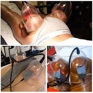 Alat Pijat Pembesar Payudara dan Pengencang Bokong 32 Cup, Terapi Vakum Pengangkat Bokong, Peralatan <span class=keywords><strong>Salon</strong></span> Kecantikan, Produk Terlaris - Product Image 5