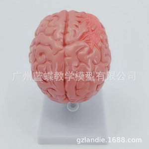 Anatomía del cerebro humano; modelo de cerebro/ictus; modelo de enfermedad cerebral; hemorragia cerebral; modelo anatómico de lesiones cerebrales. - Product Image 2