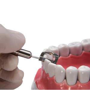 Carillas de cerámica, cuchillos estéticos dentales, consumibles orales, herramientas de unión, parches de belleza para el cuidado interdental, ciencia médica - Product Image 4