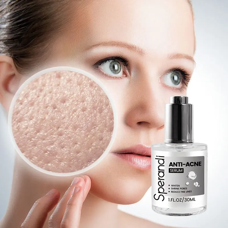 Ácido azelaico Reparación del acné Poro Reducción de brillo Blanqueamiento Hialurónico Niacinamida Péptidos Suero facial antiarrugas para pieles sensibles