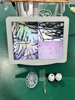 Appareil d'analyse capillaire pour salon, appareil d'analyse du cuir chevelu, microscope d'analyse capillaire, analyseur de cheveux 5 en 1, machine d'analyse du cuir chevelu et des cheveux