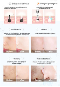 Nouvelle Machine de Dermabrasion 6-en-1 2026 pour le Nettoyage du Visage et le Peeling au Diamant, avec Jet d'Oxygène pour le Rajeunissement Cutané - Product Image 3