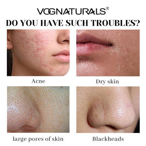 <span class=keywords><strong>Mascarilla</strong></span> Facial en Barra de Arcilla de Té Verde Vegana Natural OEM con Vitamina E, Control de Grasa, Limpieza Profunda, Minimiza Puntos Negros y Humecta - Product Image 4