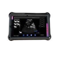 LHWBS104 Ultrasons sans fil vétérinaires avec moniteur de tablette Sonde convexe rectale à ultrasons vétérinaire