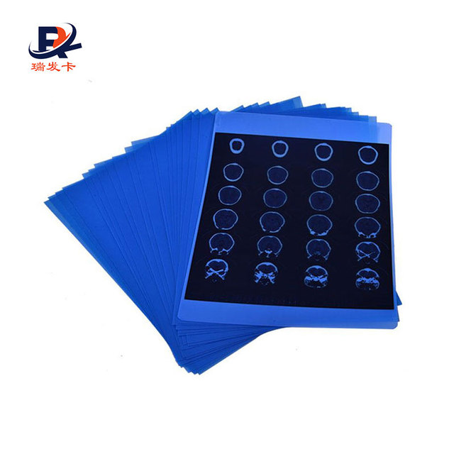 Blue 8x10 Inch 13x17cm Fuji DI HT DI-HT Dry Thermal X-ray Medical Film with Fuji Printer