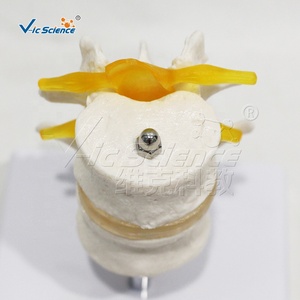 Modèle de colonne lombaire à deux segments avec disque fonctionnel, spécimen de <span class=keywords><strong>test</strong></span> biomecanique L3-L4 L4-L5, aide pédagogique médicale - Product Image 5