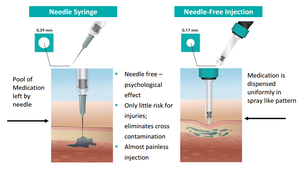 Siringa per anestesia locale orale senza dolore dentale senza ago senza dolore - Product Image 5