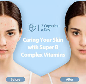 Vitaminas para el Manejo del Estrés, Suplemento de Vitamina <span class=keywords><strong>B</strong></span> en Cápsulas para el Metabolismo y la Salud del Sistema Nervioso, Vitaminas <span class=keywords><strong>B</strong></span> Activas - Product Image 2