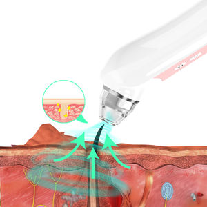 Estrattore di Punti Neri con Fotocamera, Strumento per la Rimozione dei Punti Neri con Aspirazione Ricaricabile USB per Punti Neri e Acne - Product Image 4