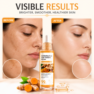 Suero Exfoliante de Ácido Kójico y Cúrcuma 80ml con 3% de Niacinamida AHA BHA Corrector de Manchas Oscuras Suero Facial Iluminador para Mujeres - Product Image 6