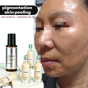 Kit de Eliminación de Manchas Oscuras y Melasma, Esponja Bio con Microagujas de Algas, <span class=keywords><strong>Gel</strong></span> Exfoliante para Manchas Negras y <span class=keywords><strong>Gel</strong></span> Calmante y Refrescante para la Piel - Product Image 1