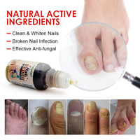 Nouveau sérum de soin des pieds de haute qualité liquide de réparation des ongles Anti-fongique pour enlever les ongles sérum nourrissant pour les orteils avec lime à ongles