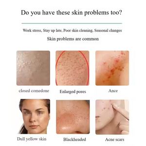 Alga <span class=keywords><strong>Peeling</strong></span> aghi Bio <span class=keywords><strong>Peeling</strong></span> ed esfoliazione 70% puro Bioneedling Spongilla Spicules Peel in polvere trattamento Acne e sbiancamento B - Product Image 3