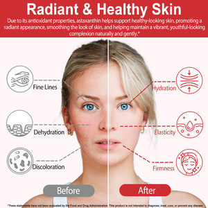 Integratori di Olio di Astaxantina da Estratti Vegetali, Capsule Softgel di Astaxantina al 5%, per la Salute degli Occhi e delle Articolazioni - Product Image 4