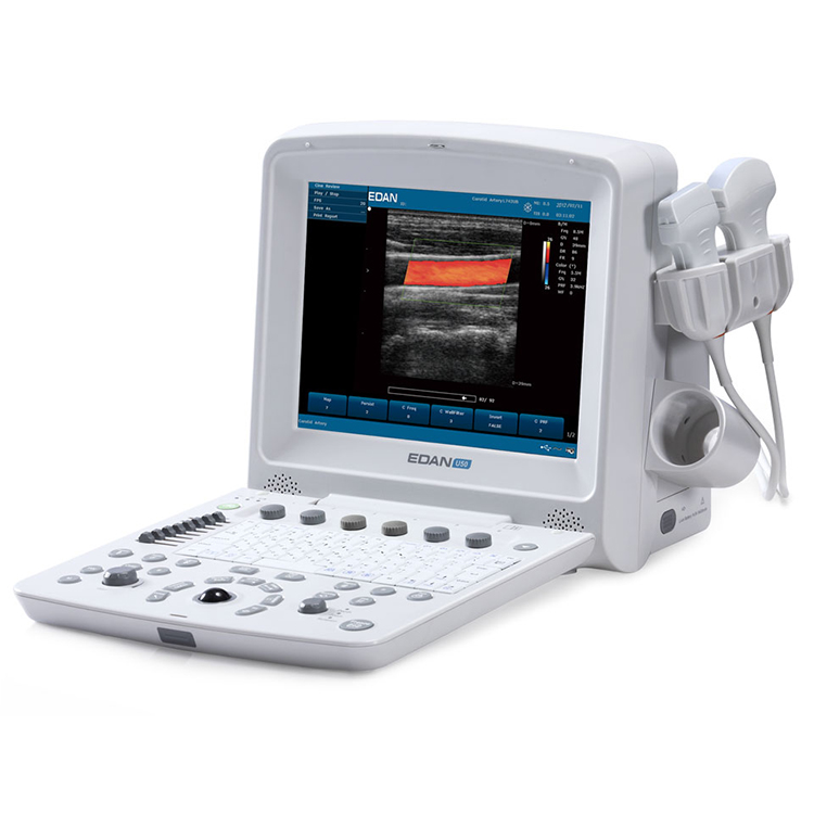 Sistema de diagnóstico de diagnóstico de Fábrica Edan U50 color gotero médico ultrasonido