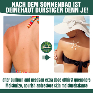 Cuidado Vegano para la Piel Después del Sol con Manteca de Cacao para Calmar e Hidratar las Quemaduras Solares, Loción de <span class=keywords><strong>Aloe</strong></span> <span class=keywords><strong>Vera</strong></span>, <span class=keywords><strong>Crema</strong></span> para Después del Sol - Product Image 4