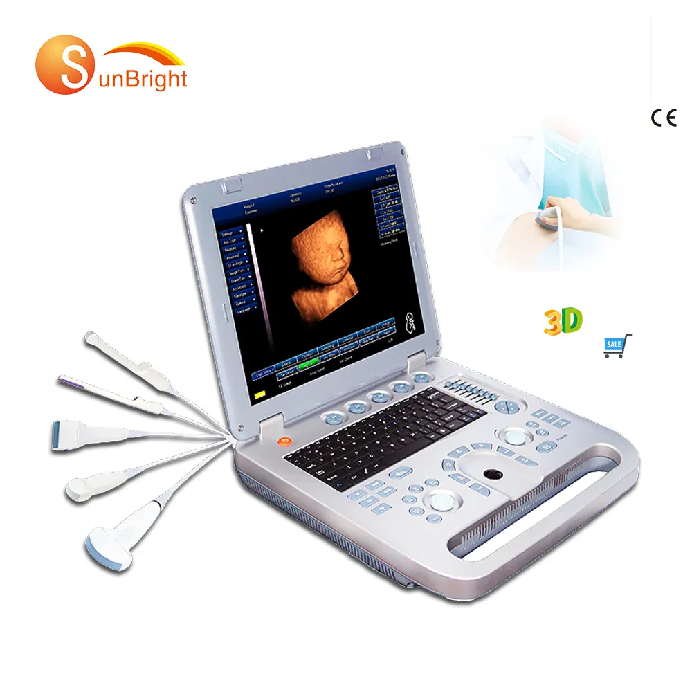Software 3D laptop medical ostetricia ginecologia scanner ad ultrasuoni ospedaliero di qualità ad ultrasuoni