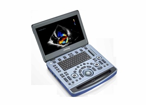 Appareil d'échographie vétérinaire portable Mindray Vetus M11 avec la meilleure qualité - Product Image 4