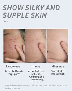 Jabón <span class=keywords><strong>de</strong></span> baño para Hotel y hogar, Hidratante Corporal barra <span class=keywords><strong>de</strong></span> jabón para el cuidado <span class=keywords><strong>de</strong></span> la piel, personalizado, flor <span class=keywords><strong>de</strong></span> aminoácido, hecho a mano - Product Image 3