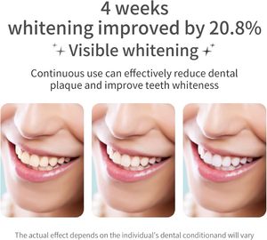 Cepillo de Dientes Eléctrico Inteligente para Adultos, con Alta Frecuencia de Vibración, Bajo Ruido, Resistente al Agua IPX7, Cerdas Medianas, para Uso Doméstico, Venta al Por Mayor - Product Image 2