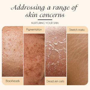 <span class=keywords><strong>Aceite</strong></span> Exfoliante Facial y Corporal <span class=keywords><strong>de</strong></span> Venta Caliente, Extra Fuerte, con Niacinamida y Ácido Salicílico, Reduce las <span class=keywords><strong>Cicatrices</strong></span> del Acné, <span class=keywords><strong>Aceite</strong></span> Exfoliante Amarillo - Product Image 4