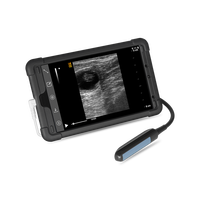 Équipement d'ultrason portable basé sur des applications, équipement de vétérinaire à écran tactile