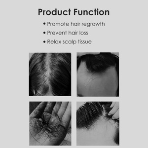 Peignes de massage du cuir chevelu personnalisés avec logo, peignes et brosses à cheveux avec logo - Product Image 3