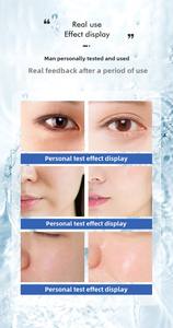 Removedor de Cravos 360 6 em 1 2025 Máquina de Hidrodermoabrasão para Limpeza Facial/Máquina de Hidrodermoabrasão Escova de Limpeza Facial para Rugas - Product Image 3