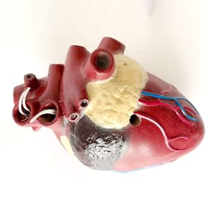 Modelo de Anatomía Visceral Animal Yulin YL2-70003 para la Enseñanza de Patologías Viscerales en Perros, Modelo de Corazón con <span class=keywords><strong>Dirofilaria</strong></span> Immitis - Product Image 4