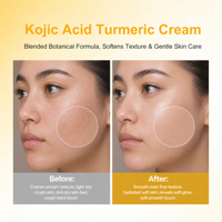 Crème pour le visage à l'acide kojique et à l'extrait de racine de curcuma, hydratant au lactobacillus pour le soin quotidien de la texture de la peau
