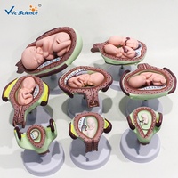 Modelo de Crecimiento Fetal Multietapa con Útero y Placenta, Ayuda de Entrenamiento Médico en Embriología para Escuelas de Obstetricia, CE/ISO/ROHS/CNAS
