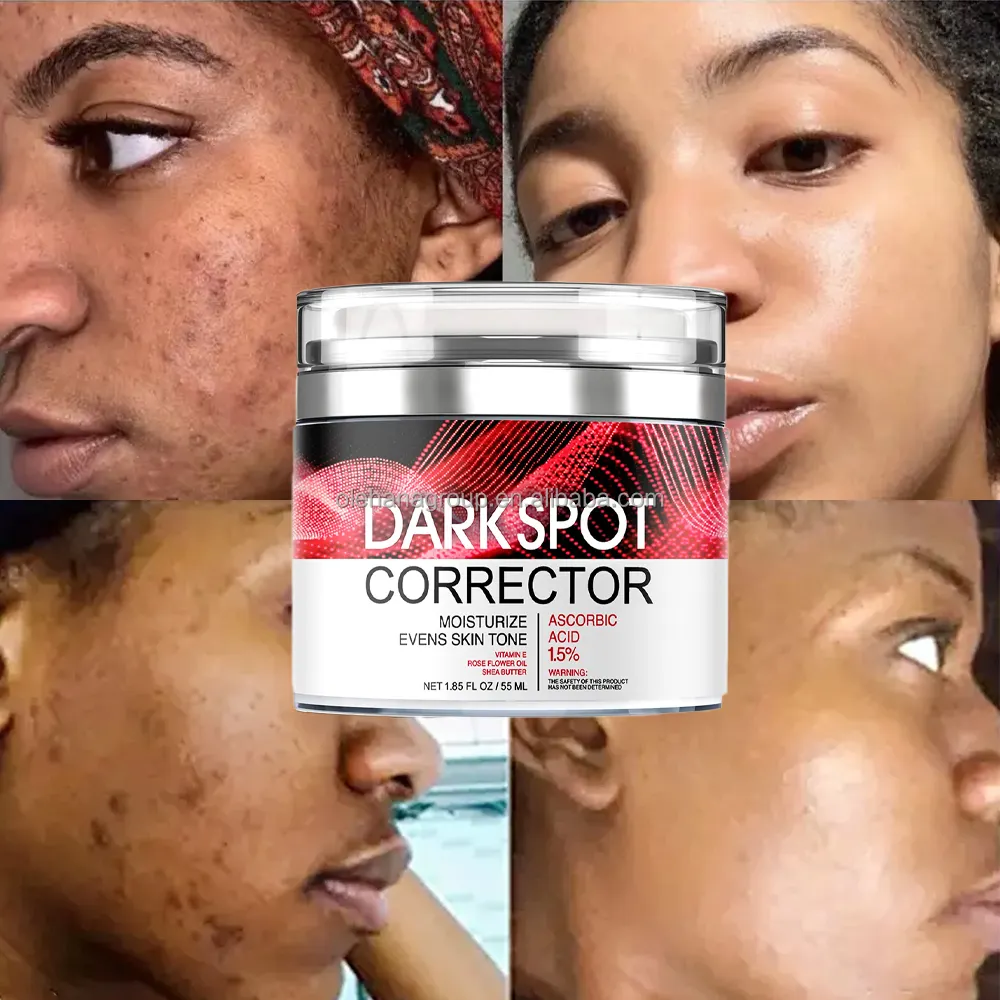 Miglior Anti invecchiamento rughe pelle nera trattamento dell'acne sbiancamento del corpo Private Label rimozione macchie scure crema per il viso