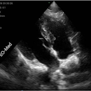 Mini-sonde d'échographie à réseau phasé USB et sans fil, scanner échographique Doppler couleur CU18 - Product Image 6