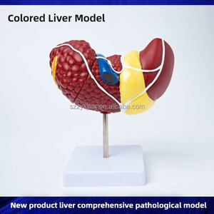 Modèle anatomique du foie pathologique humain pour l'école de médecine pour l'étude et la recherche sur les caractéristiques pathologiques du foie - Product Image 4
